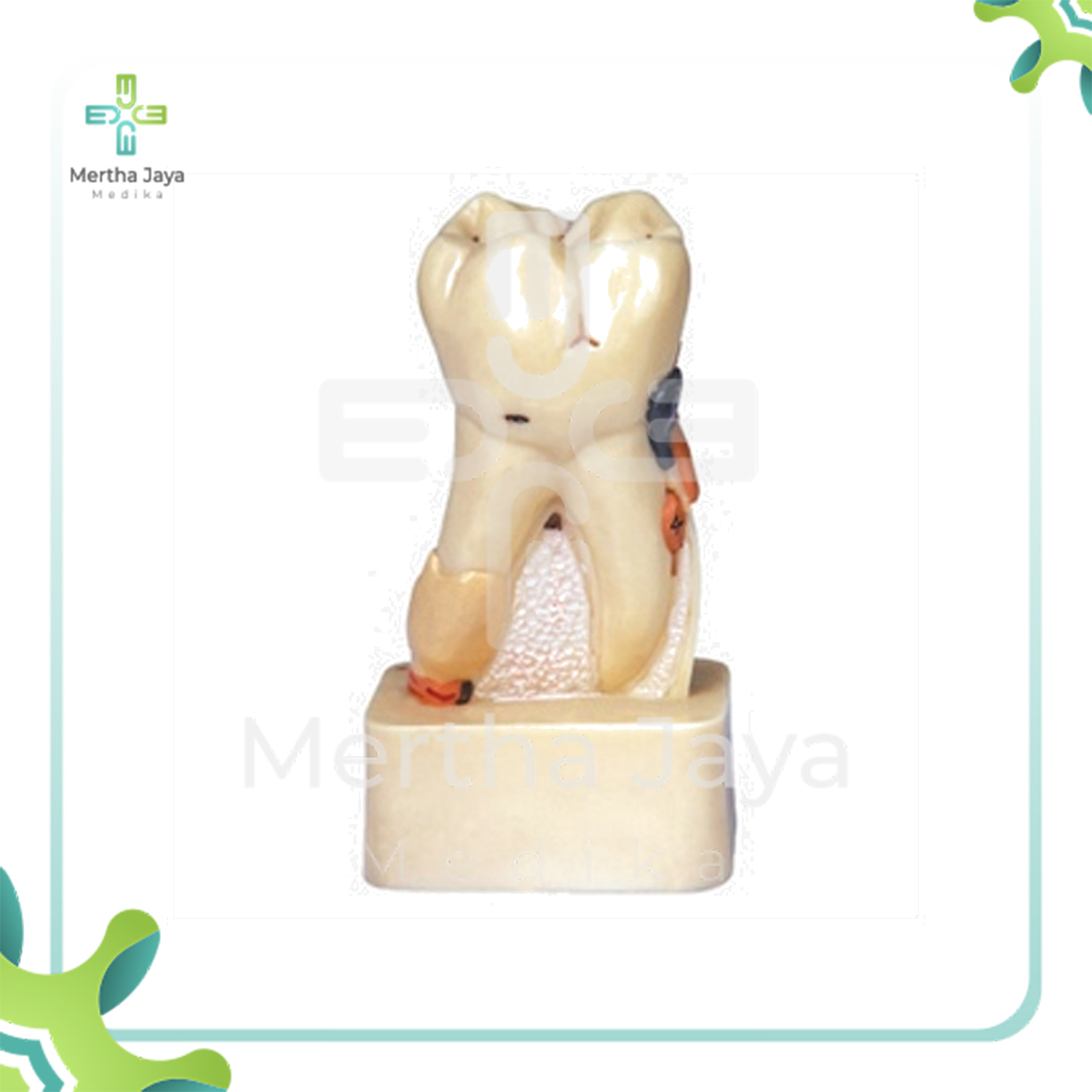 GD_B10008 Dissected Model of Dental Disease