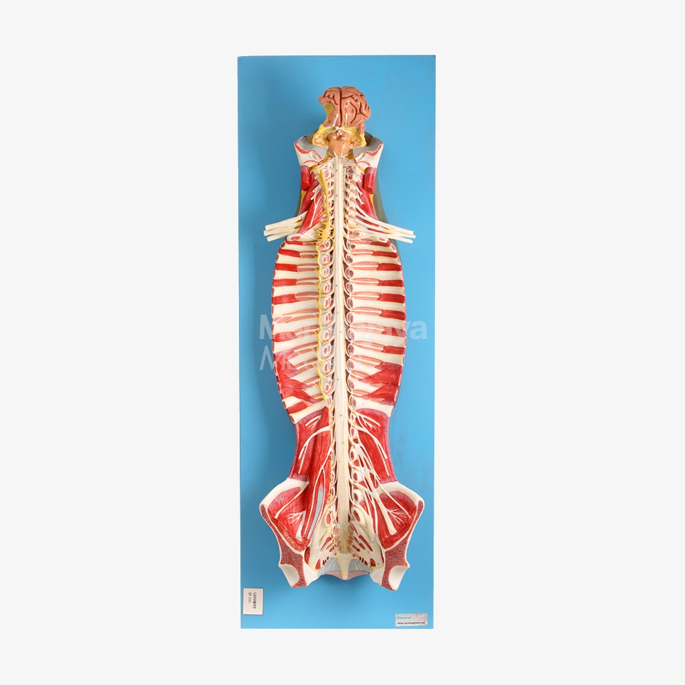 Sumsum Tulang Belakang dan Saraf Tulang Belakang Di Kanal Tulang Belakang_Spinal Cord and Spinal Nerves in the Spinal Canal - GD_A18102